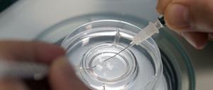 Umstrittene Technik. Eizellen werden in einer Kinderwunschpraxis präpariert. 