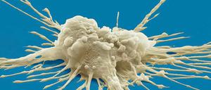 Pluripotente Stammzelle. Alexander Meissner gefällt, dass die Max-Planck-Gesellschaft explizit zur Grundlagenforschung steht. 