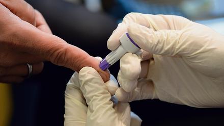 Beim HIV-Schnelltest ist je nach Hersteller das Ergebnis zwischen 5 und 30 Minuten ablesbar. 