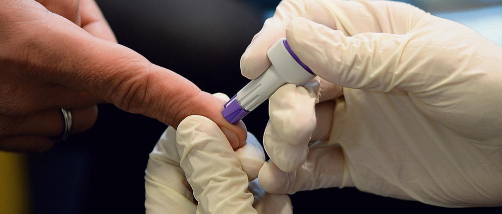Beim HIV-Schnelltest ist je nach Hersteller das Ergebnis zwischen 5 und 30 Minuten ablesbar. 