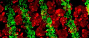 Ingenieurskunst. Aus Leberzellen, Bindegewebezellen und Zellen der Gefäßinnenwand züchten Forscher Leber-ähnliche Strukturen.