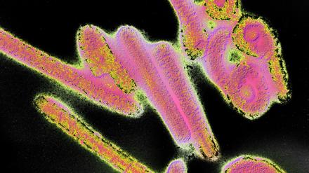 Das Marburg-Virus wurde mit Versuchsaffen aus Unganda in die Laboratorien des Pharmakonzerns Behringwerke in Hessen eingeschleppt.