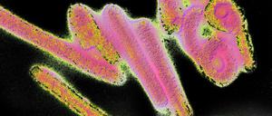 Das Marburg-Virus wurde mit Versuchsaffen aus Unganda in die Laboratorien des Pharmakonzerns Behringwerke in Hessen eingeschleppt.