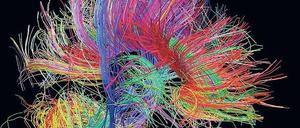 Kann das Hormon Oxytocin das Gehirn so verändern, dass Menschen Fremden aufgeschlossener gegenübertreten? Experimente in Bonn deuten darauf hin. 