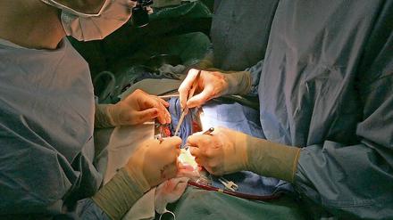 Herzoperation im Krankenhaus. Herz-Kreislauf-Erkrankungen verursachen in Deutschland die höchsten Krankheitskosten. 
