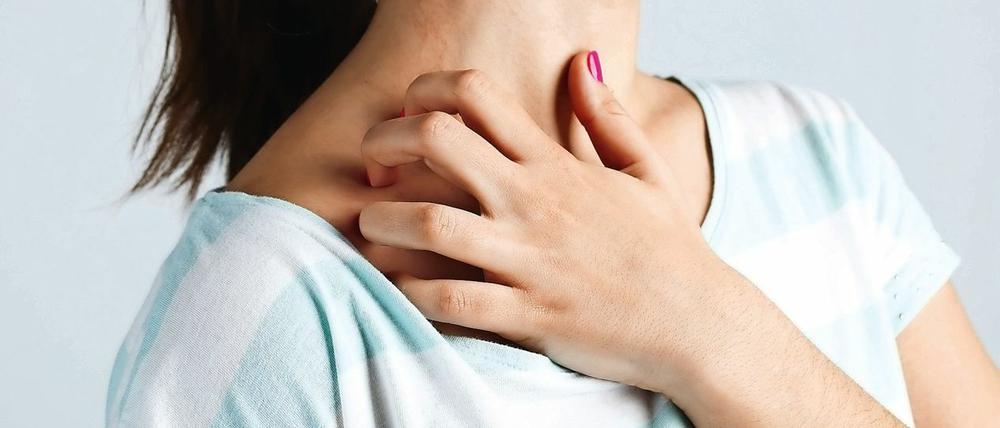 Juckreiz quält Neurodermitis-Patienten besonders - und verschlimmert die Krankheit.