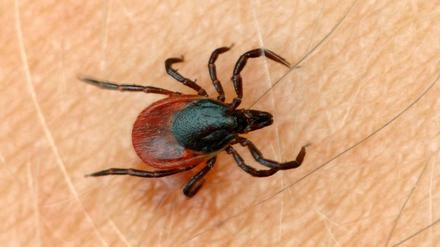 Der gemeine Holzbock (Ixodus ricinus) auf der Haut eines Menschen.