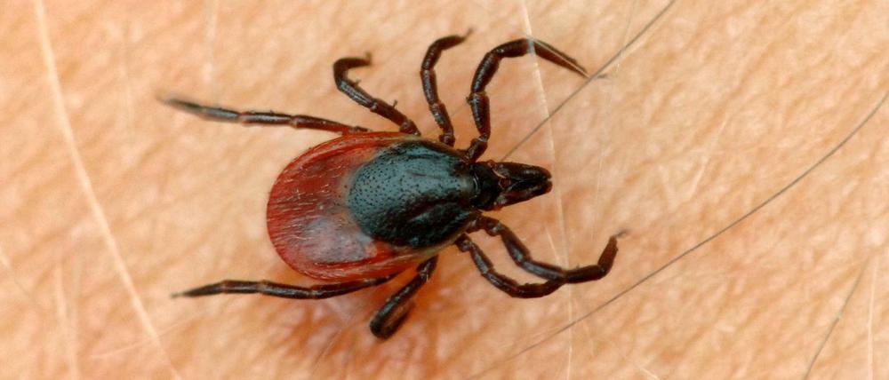 Der gemeine Holzbock (Ixodus ricinus) auf der Haut eines Menschen.