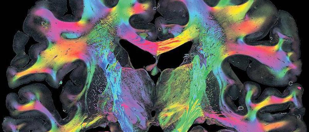Großzügig oder Egoistisch? Das Striatum, eine Struktur in der Mitte des Gehirns, bewertet unsere Entscheidungen.