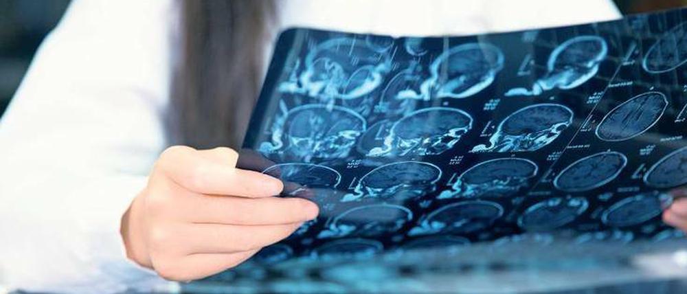 Mediziner filtern heute viele Informationen über die Gesundheit des Patienten aus Bildern. 