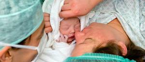 Der Kaiserschnitt ist in Deutschland inzwischen ein Routineeingriff. Das wirkt sich auch auf unseren Genpool aus.