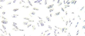 Zellsuppe. Um einzelne Zellen untersuchen zu können (hier Herzmuskelzellen), muss das Gewebe erst aufgelöst werden.