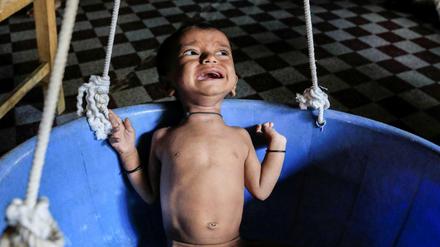 Ein unterernährter Rohingya-Junge in einem Flüchtlingslager in Bangladesch.