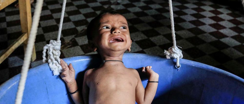 Ein unterernährter Rohingya-Junge in einem Flüchtlingslager in Bangladesch.
