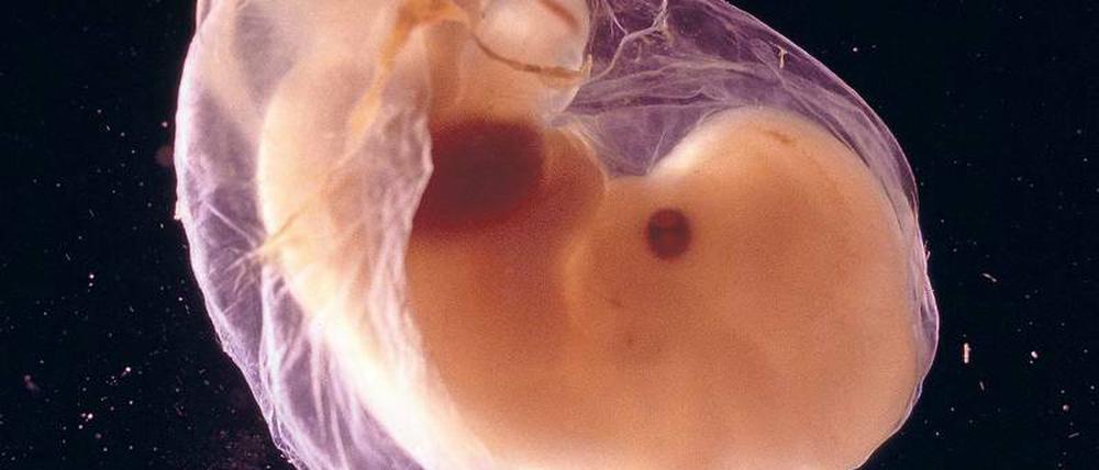Schützling. In den ersten Wochen der Schwangerschaft sind Embryonen besonders anfällig für Fehlentwicklungen. Leicht geraten Medikamente, die die Mutter in dieser Zeit nimmt, in den Verdacht, der Auslöser dafür zu sein. Nicht immer zu Recht.