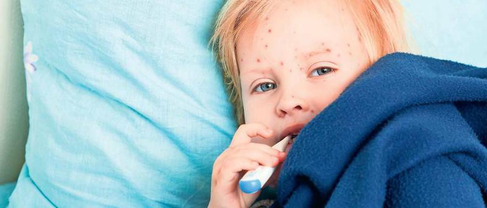 Eine (Kinder-)Krankheit mit Folgen: Auch wer die Windpocken überstanden hat, trägt das Herpesvirus ein Leben lang in sich.