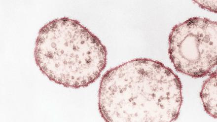Der Masernvirus (Paramyxoviren) unter einem Transmissions-Elektronenmikroskopie