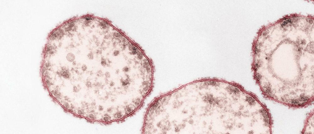 Der Masernvirus (Paramyxoviren) unter einem Transmissions-Elektronenmikroskopie