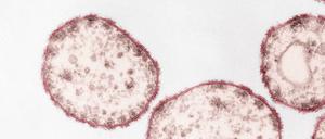 Der Masernvirus (Paramyxoviren) unter einem Transmissions-Elektronenmikroskopie