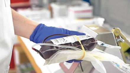 Transfusion. Die T-Zellen aus dem Blut des Patienten werden ihm verändert zurückgegeben, damit sie den Krebs angreifen. 