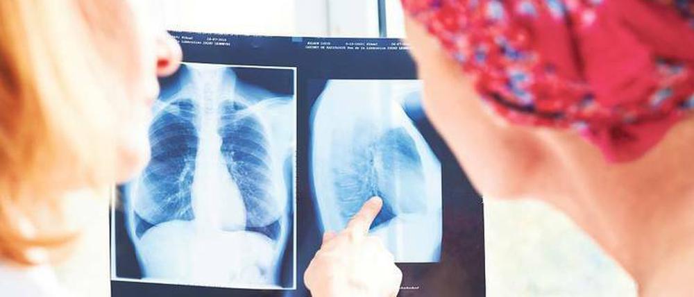 Wiederbelebte Gegenwehr. Eigentlich kann das Immunsystem Krebszellen erkennen und zerstören. Doch Signale des Tumors lähmen die Abwehrzellen. Diese Stoffe können Ärzte inzwischen mit Antikörpern abfangen. Das hilft vor allem Lungenkrebspatienten.