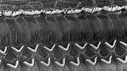Die inneren (oben) und äußeren Haarzellen in der Innenohrschnecke sind die Zellen, die letztlich für die Umwandlung der Schallwellen in elektrische Impulse sorgen, die über den Hörnerv ans Gehirn weitergeleitet werden. 