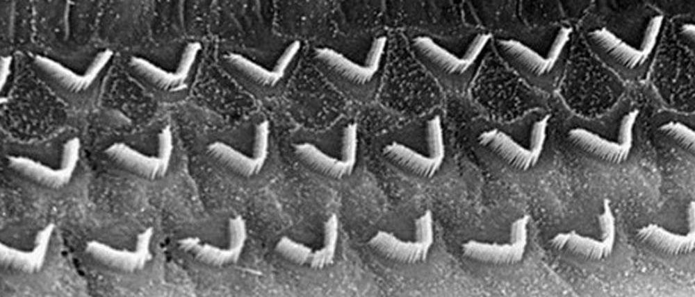 Die inneren (oben) und äußeren Haarzellen in der Innenohrschnecke sind die Zellen, die letztlich für die Umwandlung der Schallwellen in elektrische Impulse sorgen, die über den Hörnerv ans Gehirn weitergeleitet werden.