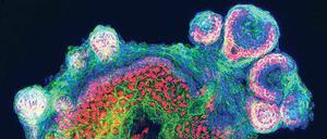 Haarig. Stammzellen bilden Zysten (kugelförmige Gebilde am Rand) aus Hautzellen (rot) mit Haaren. 