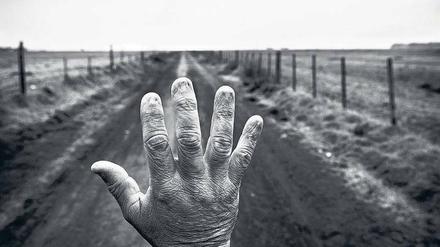 Die Spätfolgen. Alfredo Cerán brachte neun Jahre lang Unkrautvernichtungsmittel auf Sojafeldern aus. Die Aufnahme seiner entstellten Hand entstand 2015 in Argentinien. 