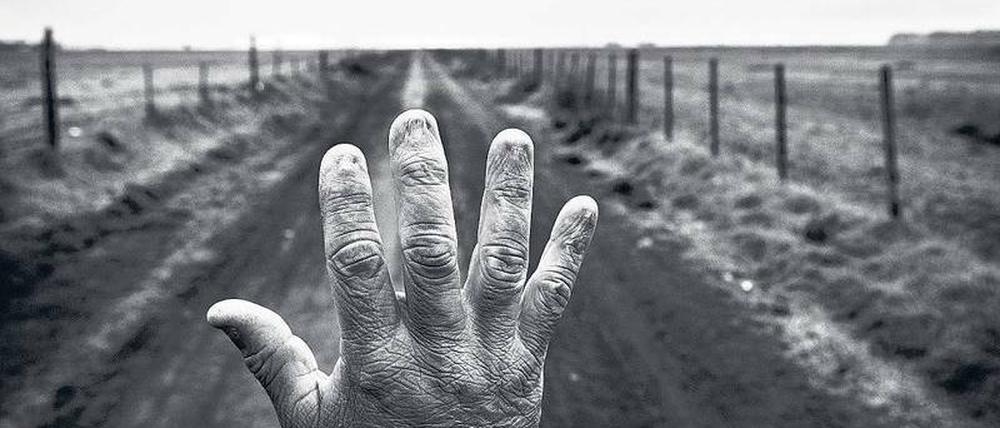 Die Spätfolgen. Alfredo Cerán brachte neun Jahre lang Unkrautvernichtungsmittel auf Sojafeldern aus. Die Aufnahme seiner entstellten Hand entstand 2015 in Argentinien. 