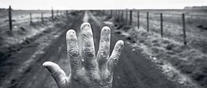 Die Spätfolgen. Alfredo Cerán brachte neun Jahre lang Unkrautvernichtungsmittel auf Sojafeldern aus. Die Aufnahme seiner entstellten Hand entstand 2015 in Argentinien.