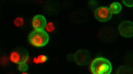 Hefezellen enthalten etwa 42 Millionen Proteinmoleküle.