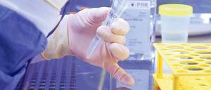 Symbolbild zur Forschungsarbeit im medizinischen Labor.