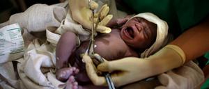 Kampf ums Überleben: Neugeborenes im Südsudan