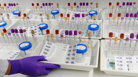 In den Kliniken kommt die Wissenschaft den Patienten am nächsten, doch viele Ärzte haben für das Forschen (wie etwa mit Proben von Studienteilnehmern, hier der Nako-Gesundheitsstudie) kaum noch Zeit. 