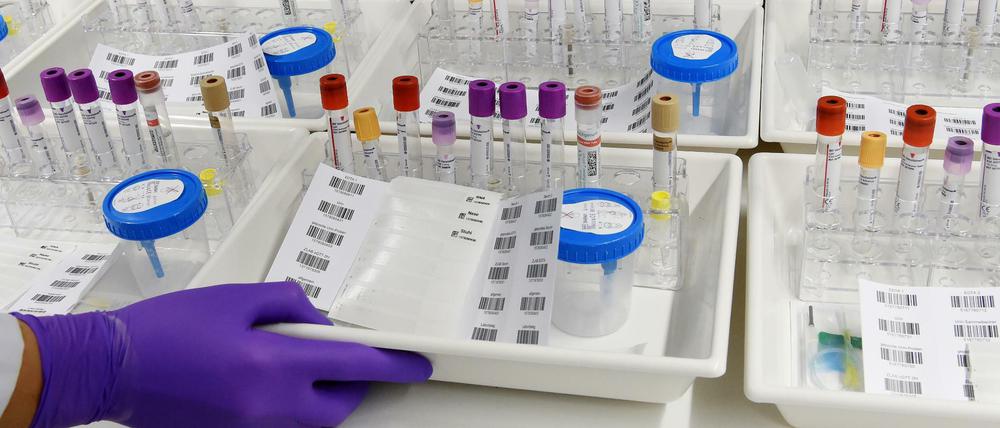 In den Kliniken kommt die Wissenschaft den Patienten am nächsten, doch viele Ärzte haben für das Forschen (wie etwa mit Proben von Studienteilnehmern, hier der Nako-Gesundheitsstudie) kaum noch Zeit. 