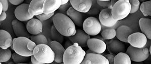 Erst die Hefe macht das Bier - indem sie Zuckerbestandteile der Gerste in Alkohol und andere Stoffe umwandelt. 