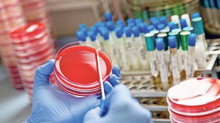 Test auf resistente Bakterien: Weltweit ist der Verbrauch von Reserve-Antibiotika gestiegen, die als letzte Waffe gegen resistente Mikroben wie MRSA (Methicillin Resistente Staphylokokkus Aureus) gelten. 