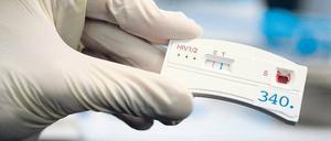 Blutspur. Kondom geplatzt, ungeschützter One-Night-Stand – gegen die Sorge um eine HIV-Infektion gibt es in Großbritannien und Frankreich Heimtests. Allerdings ist die Methode nicht perfekt. In Deutschland steht eine Zulassung daher noch aus. 