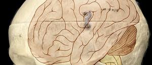 Das Gehirn von Homo sapiens ist etwa dreimal so groß wie von Menschenaffen.