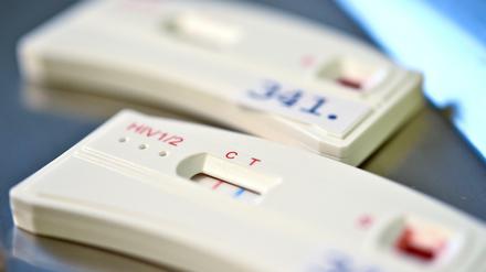 HIV-Schnelltests (Symbolbild)