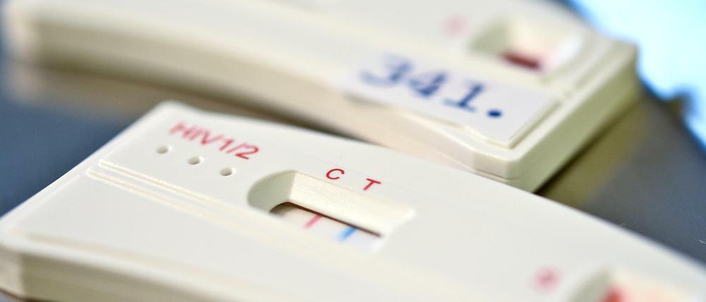 HIV-Schnelltests (Symbolbild)