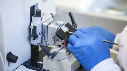 Gentest Oncotype DX: Erstellung eines hauchdünnen Gewebeschnitts aus dem Paraffinblock des Tumors. 