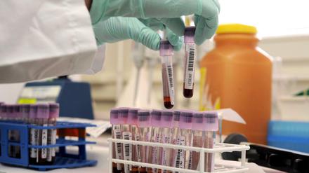 Bis aufs Blut. Dopingtests muten den Athletinnen und Athleten viel zu. Aber was ist die Alternative?