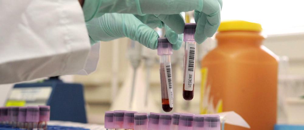 Bis aufs Blut. Dopingtests muten den Athletinnen und Athleten viel zu. Aber was ist die Alternative?