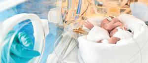 Spezialisierte Geburtskliniken wie in Neukölln bringen heute viele Frühgeburten durch.