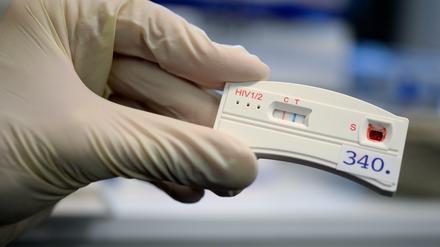 HIV-Tests gehören zu den Laborverfahren, die vor einem Ansatz vergleichsweise streng überprüft werden. Bei anderen Blutuntersuchungsverfahren sind die Leistungstests vor der Markteinführung weniger penibel.