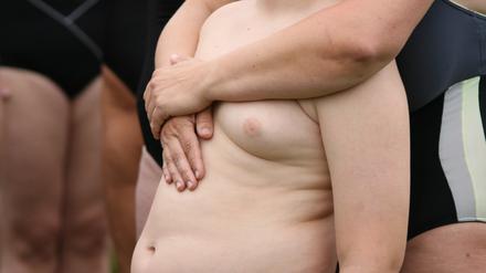 Rund 12.000 Berliner Kinder und Jugendliche sind übergewichtig.