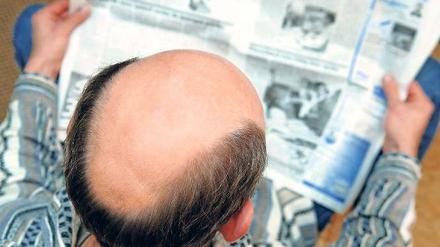 Ist bald Schluss mit der Glatze?