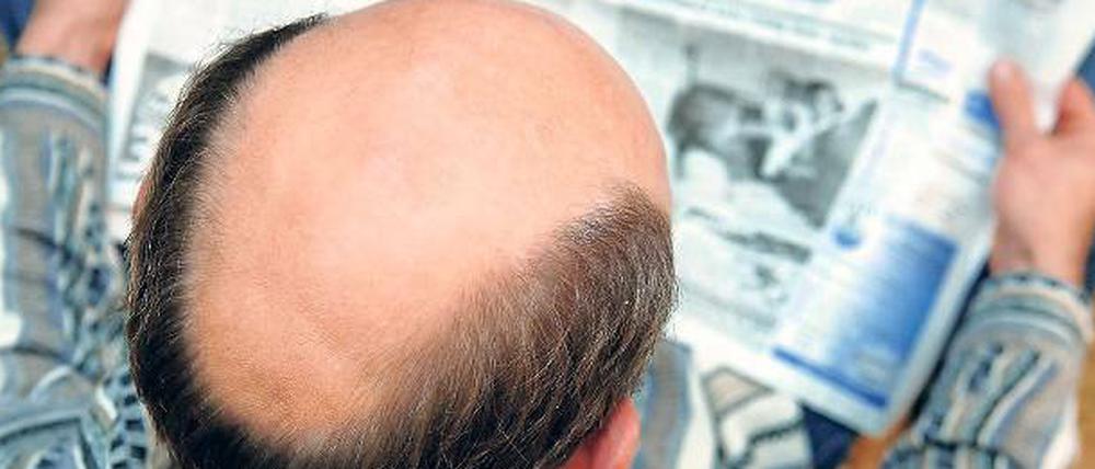 Ist bald Schluss mit der Glatze?
